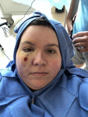 Renee Edge is prepped for surgery to remove all the cancerous tissue from the area around the original spot.